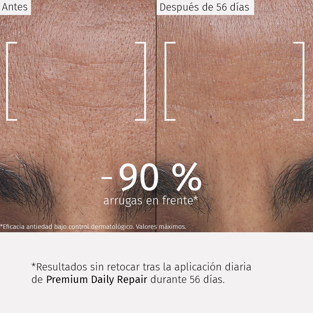 Comparativa del aspecto de la piel en la frente antes y después de utilizar Premium Daily Repair tras 56 días