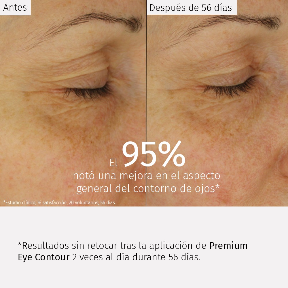 Comparativa del aspecto del contorno de ojos antes y después de 56 días de uso de Premium Eye Contour
